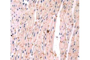 Used in DAB staining on fromalin fixed paraffin- embedded heart tissue (PIM1 Antikörper  (AA 122-261))