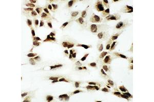 Immunohistochemistry (IHC) image for anti-Nuclear Respiratory Factor 1 (NRF1) (AA 272-288), (Middle Region) antibody (ABIN3044020)