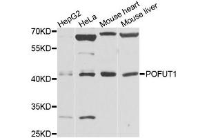 Western blot analysis of extracts of various cells, using POFUT1 antibody. (POFUT1 Antikörper)