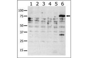 Western blot analysis of anti-K6 b (ABIN392439 and ABIN2842037) in lysates from transiently transfected COS7 cells. (PAK6 Antikörper  (AA 116-146))