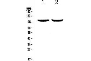 Western blot analysis of Dynamin 2 using anti-Dynamin 2 antibody . (DNM2 Antikörper  (AA 177-441))