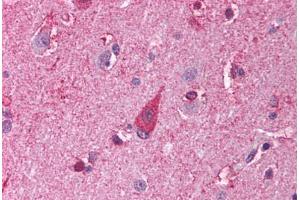 Human Brain, Cortex (formalin-fixed, paraffin-embedded) stained with TLR8 antibody ABIN214003 at 5 ug/ml followed by biotinylated goat anti-rabbit IgG secondary antibody ABIN481713, alkaline phosphatase-streptavidin and chromogen. (TLR8 Antikörper)