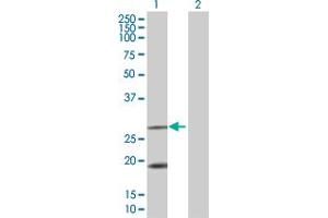 Lane 1: FXN transfected lysate ( 23.