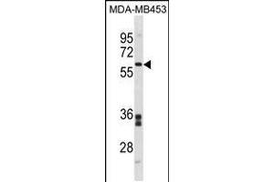 Western blot analysis in MDA-MB453 cell line lysates (35ug/lane). (FMO5 Antikörper  (C-Term))