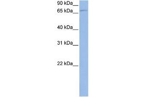 WB Suggested Anti-TBK1 Antibody Titration: 0. (TBK1 Antikörper  (N-Term))