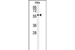 Western blot analysis in Hela cell line lysates (35ug/lane). (GALNT4 Antikörper  (N-Term))