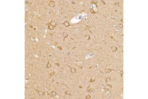 Immunohistochemistry (IHC) image for anti-Regulator of Calcineurin 1 (RCAN1) (AA 60-245) antibody (ABIN6146811)