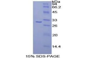 SDS-PAGE analysis of Human CELSR2 Protein. (CELSR2 Protein)