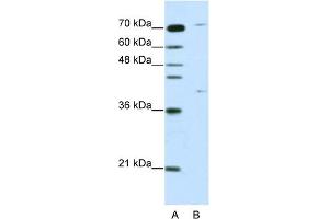 WB Suggested Anti-ZNF668 Antibody Titration:  1. (ZNF668 Antikörper  (C-Term))