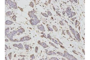 Immunohistochemistry (IHC) image for anti-DKK3 antibody (ABIN1872281) (DKK3 Antikörper)