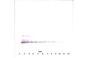 Image no. 1 for anti-Interleukin 17A (IL17A) antibody (ABIN465353) (Interleukin 17a Antikörper)