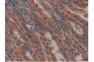 IHC-P analysis of Mouse Stomach Tissue, with DAB staining. (FLT4 Antikörper  (AA 30-326))