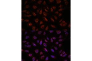 Immunofluorescence analysis of U-2 OS cells using DDX24 antibody (ABIN7266691) at dilution of 1:100. (DDX24 Antikörper  (AA 510-859))