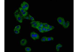 Immunofluorescence staining of HepG2 cells with ABIN7162742 at 1:166, counter-stained with DAPI. (SLC26A4 Antikörper  (AA 592-655))