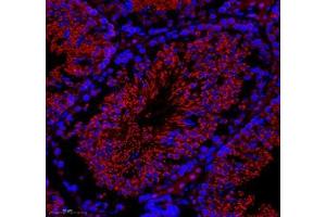Immunofluorescence of paraffin embedded rat testis using GK2 (ABIN7074096) at dilution of 1: 500 (300x lens) (GK2 Antikörper)