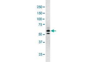 The RAD9A (phospho S277) polyclonal antibody  is used in Western blot to detect Phospho-RAD9A-S277 in Y-79 cell lysate