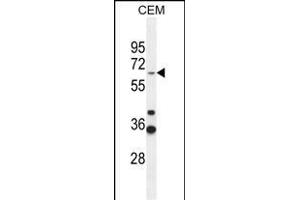 ZN Antibody (Center) (ABIN654509 and ABIN2844236) western blot analysis in CEM cell line lysates (35 μg/lane). (ZNF667 Antikörper  (AA 303-331))