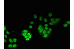 Immunofluorescence (IF) image for anti-Nudix (Nucleoside Diphosphate Linked Moiety X)-Type Motif 1 (NUDT1) (AA 49-82) antibody (ABIN7142858)