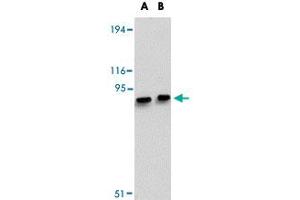 Western blot analysis of MACC1 in mouse liver tissue lysate with MACC1 polyclonal antibody  at (A) 1 and (B) 2 ug/mL . (MACC1 Antikörper  (Internal Region))