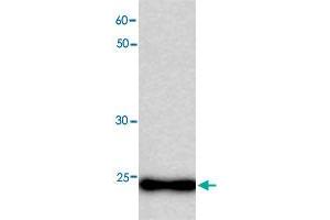 Western blot analysis in MB recombinant protein with MB monoclonal antibody, clone 34h5  at 1 : 1000 dilution. (Myoglobin Antikörper)