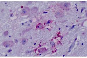 Anti-PPYR1 antibody IHC staining of human brain, hypothalamus. (NPY4R Antikörper  (Cytoplasmic Domain))