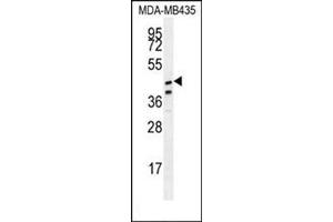 Western blot analysis in MDA-MB435 cell line lysates (35 µg/lane) using SAMD7 Antibody (Center) Cat. (SAMD7 Antikörper  (Middle Region))