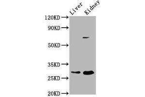 Western Blot Positive WB detected in: Rat liver tissue, Rat kidney tissue All lanes: PEX11A antibody at 2. (PEX11A Antikörper  (AA 106-219))