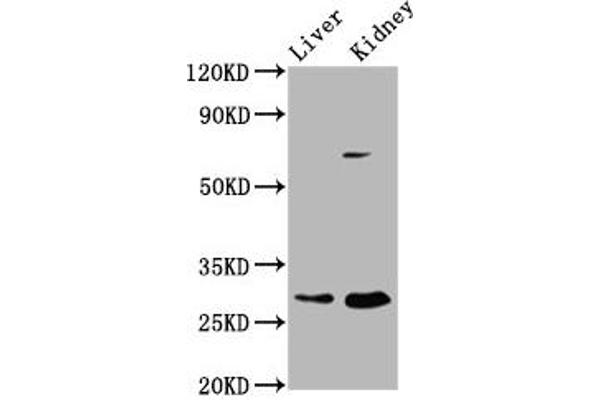 PEX11A Antikörper  (AA 106-219)