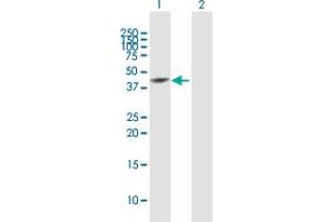 Western Blot analysis of SNUPN expression in transfected 293T cell line by SNUPN MaxPab polyclonal antibody. (Snurportin 1 Antikörper  (AA 1-360))