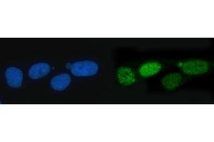 IF analysis of TIGD1 using anti-TIGD1 antibody (ABIN7602407). (TIGD1 Antikörper  (AA 74-591))
