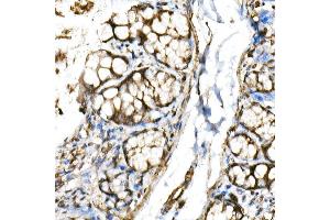 Immunohistochemistry of paraffin-embedded rat colon using BHLHE40 Rabbit pAb (ABIN6129354, ABIN6137550, ABIN6137551 and ABIN6222195) at dilution of 1:150 (40x lens). (BHLHE40 Antikörper  (AA 173-412))