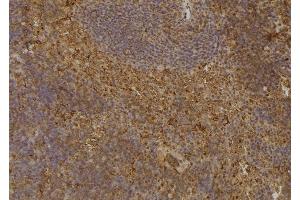 Immunohistochemistry (IHC) image for anti-Cyclin-Dependent Kinase Inhibitor 3 (CDKN3) (Internal Region) antibody (ABIN6260728)