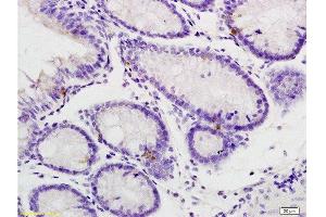 Immunohistochemistry (Paraffin-embedded Sections) (IHC (p)) image for anti-Interleukin 1 Receptor, Type I (IL1R1) (pTyr496) antibody (ABIN801423)