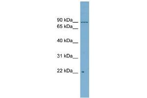 WB Suggested Anti-C12orf11 Antibody Titration: 0. (C12orf11 Antikörper  (Middle Region))