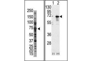 Image no. 1 for anti-Protein Inhibitor of Activated STAT, 1 (PIAS1) (N-Term) antibody (ABIN5552003) (PIAS1 Antikörper  (N-Term))