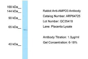 Western Blotting (WB) image for anti-Adenosine Monophosphate Deaminase 3 (AMPD3) (C-Term) antibody (ABIN2774406) (AMPD3 Antikörper  (C-Term))