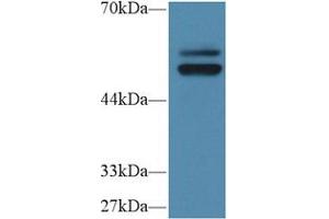 Western Blotting (WB) image for anti-Protein tyrosine Phosphatase, Non-Receptor Type 5 (Striatum-Enriched) (PTPN5) (AA 331-558) antibody (ABIN5014226)