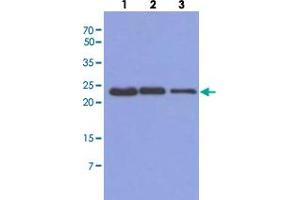 Western blot analysis of Mouse muscle extract (40 ug) by using TNNI1 monoclonal antibody, clone AT36E7  (1:500-1:5000). (TNNI1 Antikörper  (AA 1-187))