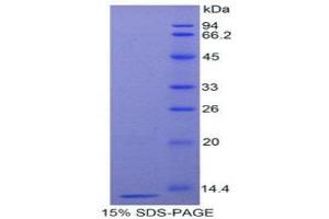 SDS-PAGE (SDS) image for CD59 (CD59) (AA 26-98) protein (His tag) (ABIN1877905) (CD59 Protein (CD59) (AA 26-98) (His tag))