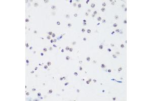 Immunohistochemistry of paraffin-embedded mouse brain using TriMethyl-Histone H3-K64 antibody (ABIN7267701) at dilution of 1:100 (40x lens).