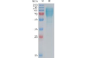 SDS-PAGE (SDS) image for Guanylate Cyclase 2C (Heat Stable Enterotoxin Receptor) (GUCY2C) (AA 20-433) protein (His tag) (ABIN7538316)
