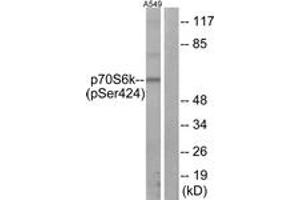 Western Blotting (WB) image for anti-Ribosomal Protein S6 Kinase, 70kDa, Polypeptide 1 (RPS6KB1) (pSer424) antibody (ABIN2888506) (RPS6KB1 Antikörper  (pSer424))