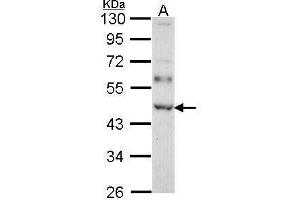 WB Image Sample (30 ug of whole cell lysate) A: Molt-4 , 10% SDS PAGE WTAP antibody antibody diluted at 1:1000 (WTAP Antikörper  (Center))