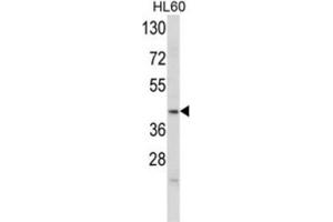 Western Blotting (WB) image for anti-Apolipoprotein L, 4 (APOL4) antibody (ABIN3002795)