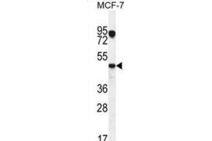 Western Blotting (WB) image for anti-Vascular Endothelial Growth Factor C (VEGFC) antibody (ABIN2996454)