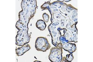 Immunohistochemistry of paraffin-embedded human placenta using CD46 Rabbit pAb (ABIN3022325, ABIN3022326, ABIN1512715, ABIN1513898 and ABIN6218741) at dilution of 1:100 (40x lens). (CD46 Antikörper  (AA 40-320))