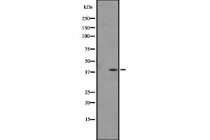 Western blot analysis of OPRL1 expression in A431 whole cell lysate ,The lane on the left is treated with the antigen-specific peptide. (OPRL1 Antikörper  (C-Term))