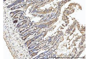 IHC analysis of CA1 using anti-CA1 antibody (ABIN3043766). (CA1 Antikörper  (AA 9-261))