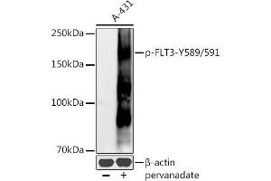 Western blot analysis of extracts of A-431 cells, using Phospho-FLT3-Y589/591 antibody (ABIN6135223, ABIN6136082, ABIN6136083 and ABIN6225559) at 1:500 dilution. (FLT3 Antikörper  (pTyr589, pTyr591))