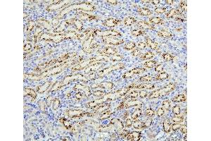 IHC analysis of TRPV5 using anti-TRPV5 antibody (ABIN7600034).